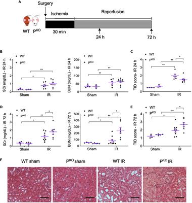 Properdin Deficiency Impairs Phagocytosis and Enhances Injury at Kidney Repair Phase Post Ischemia–Reperfusion